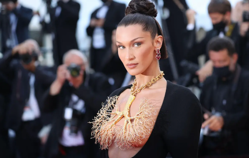 bella hadid nose plastic surgery