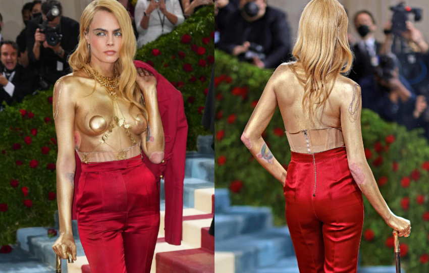 Cara Delevingne 皮膚敏感