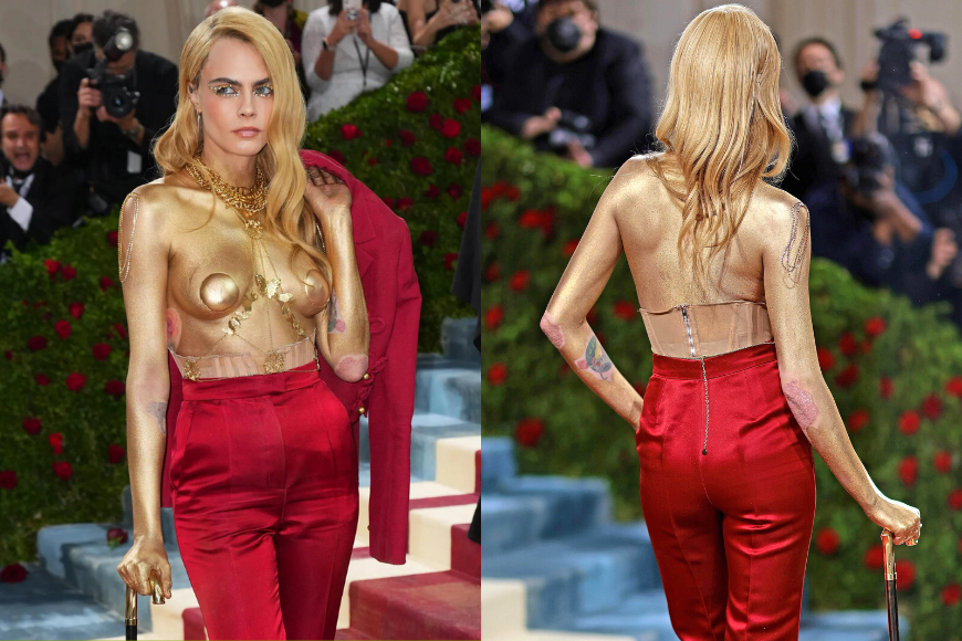 Cara Delevingne 皮膚敏感